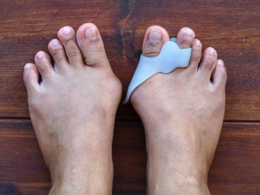 traitement hallux valgus